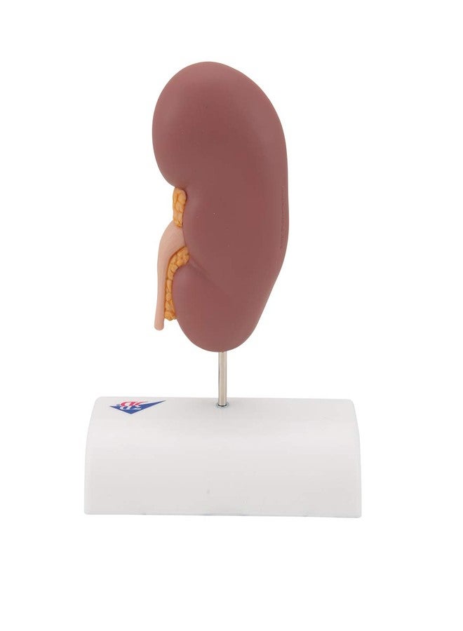 3بي ساينتفك نموذج حصى الكلى K29 من 3B Scientific - 3B Smart Anatomy - Image 4